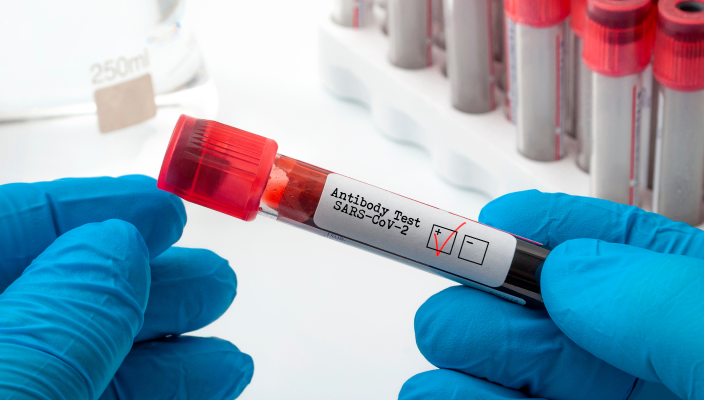 promo-testing-tips-antibody-testing-704x400